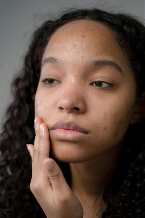 A woman examines her face, including some blemishes.