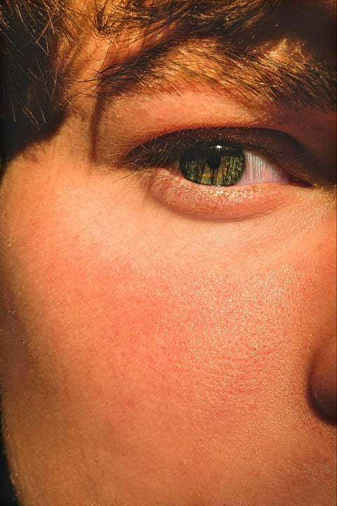 A closeup view of a person with a red hue to their skin.